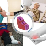 Egg Crate Foam Heel Protector - Image 5